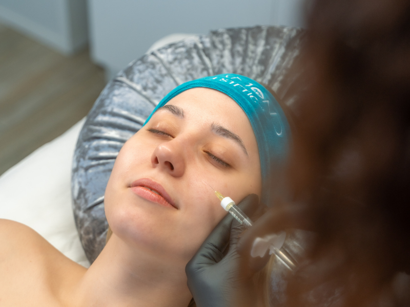 mezoterapia igłowa rozszerzona